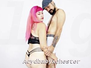 Acydbabyxchester