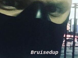 Bruisedup