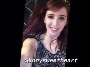 Sknnysweetheart